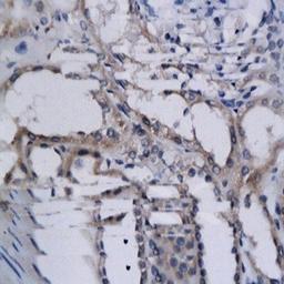 Immunohistochemical analysis of formalin-fixed paraffin embedded human kidney tissue using HIF2 alpha antibody