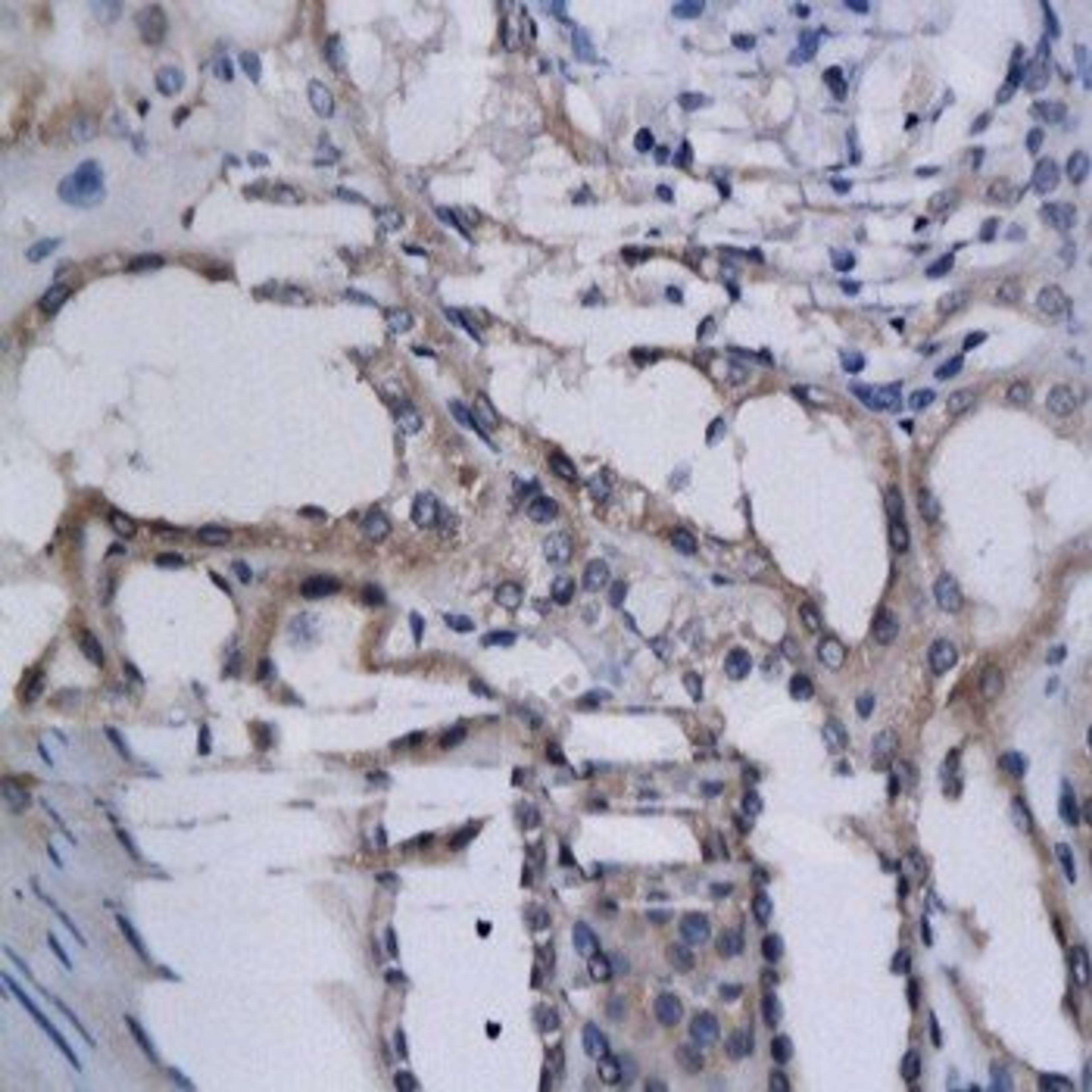 Immunohistochemical analysis of formalin-fixed paraffin embedded human kidney tissue using HIF2 alpha antibody