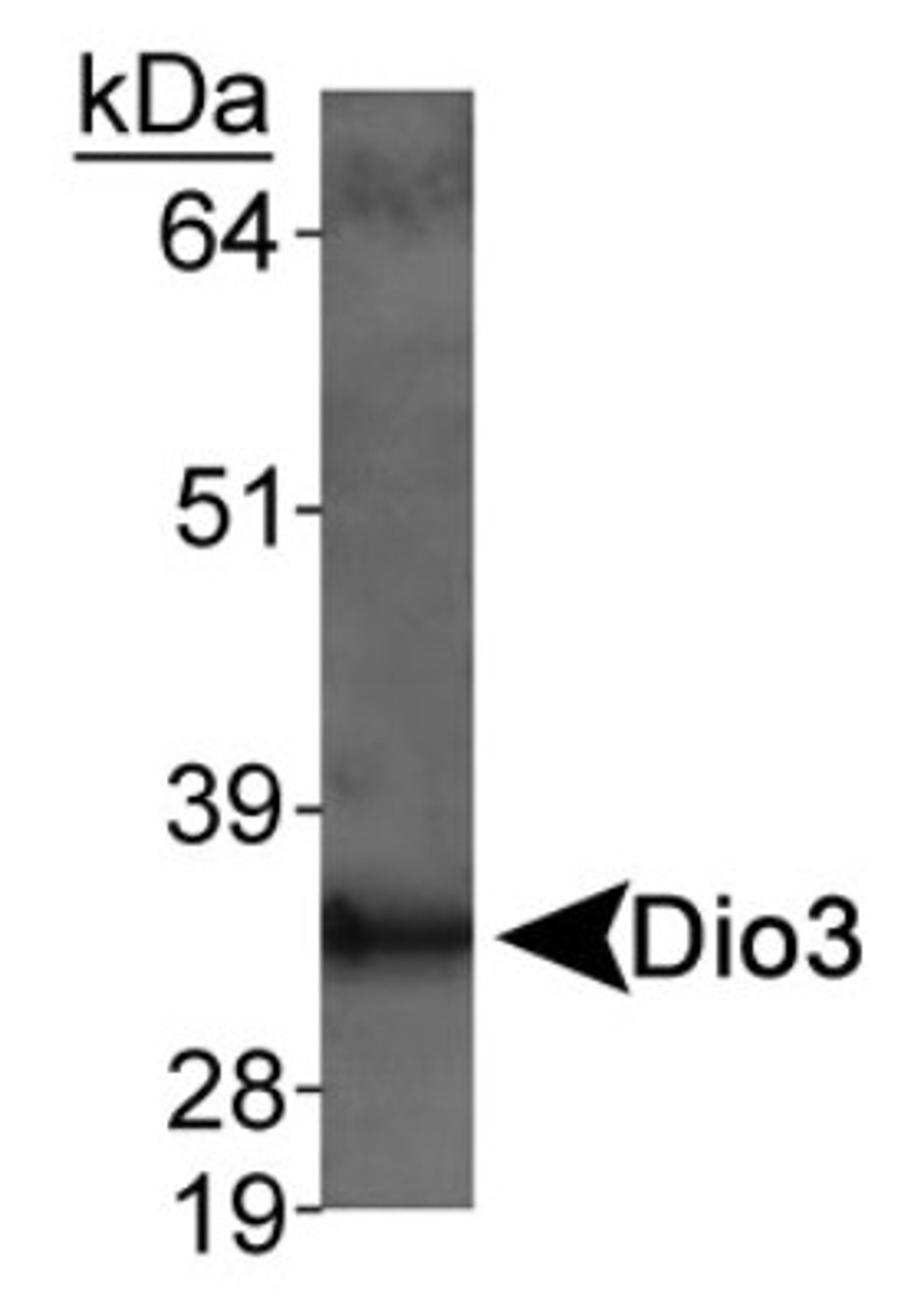 Western Blot: DIO3 Antibody [NB110-96414] - Detection of Dio3 in rat placenta