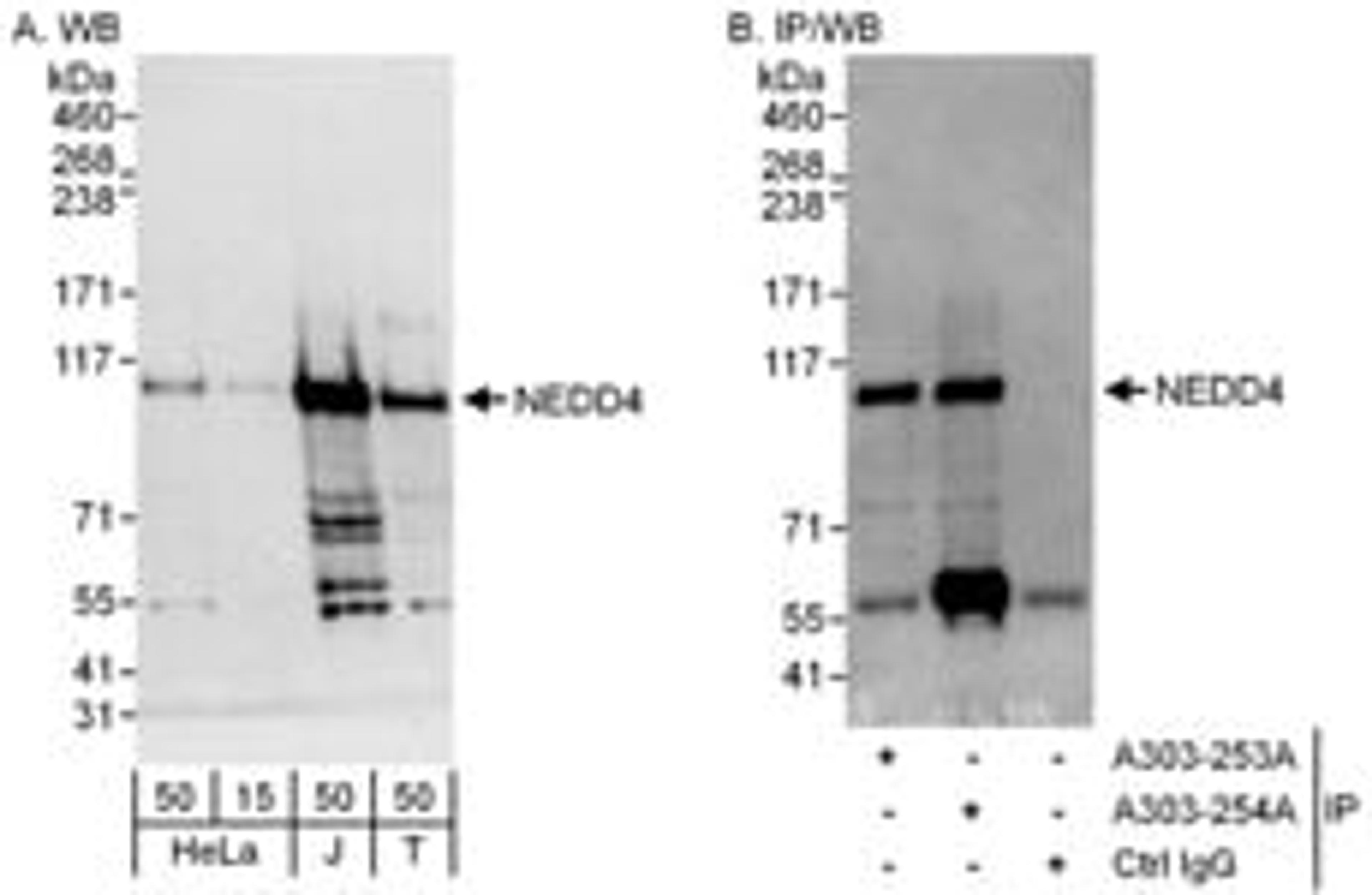 Detection of human NEDD4 by western blot and immunoprecipitation.