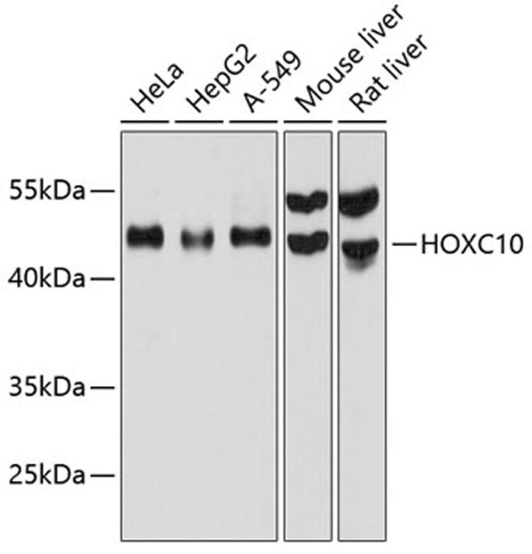 Western blot - HOXC10 antibody (A12215)