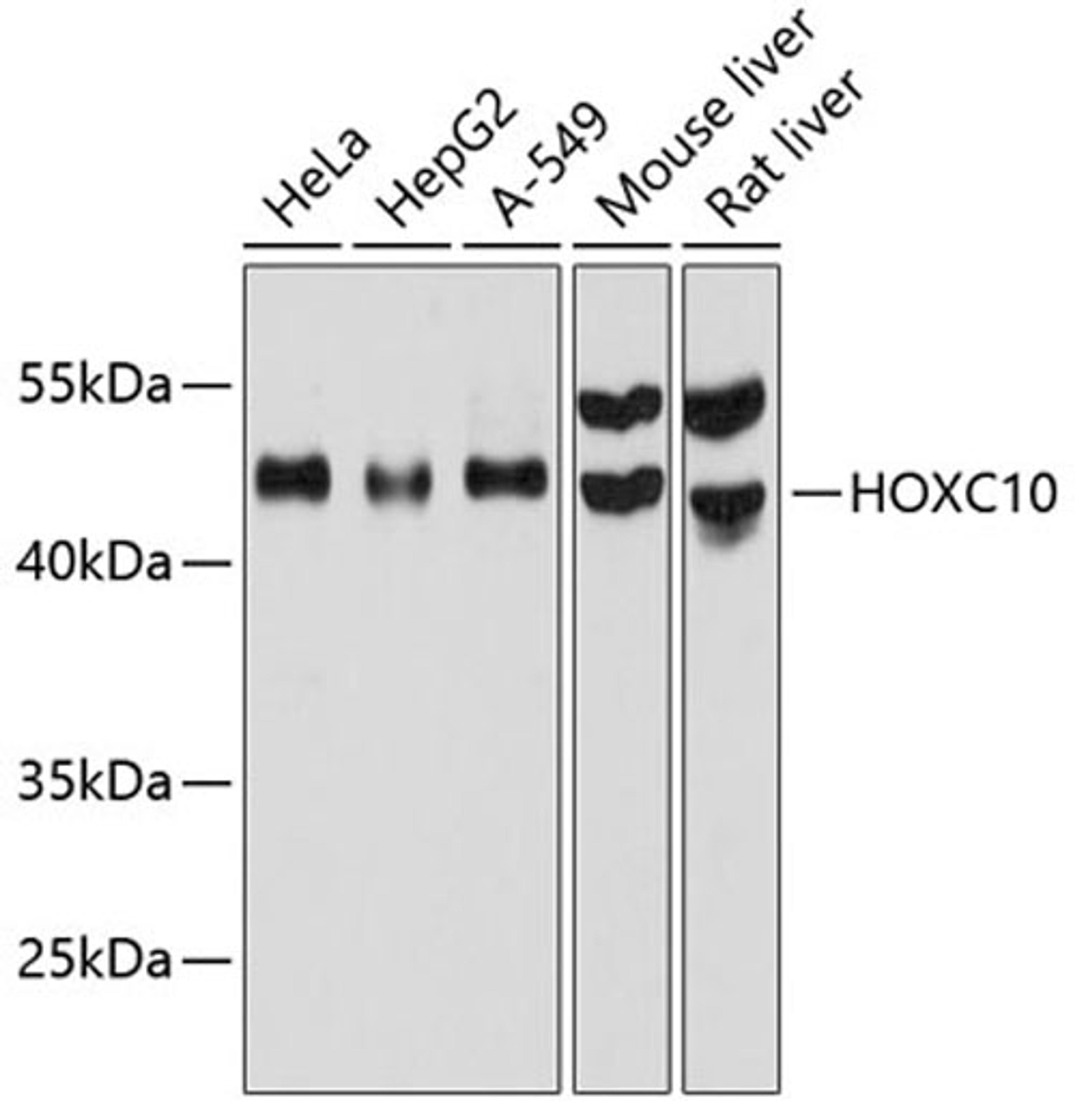 Western blot - HOXC10 antibody (A12215)