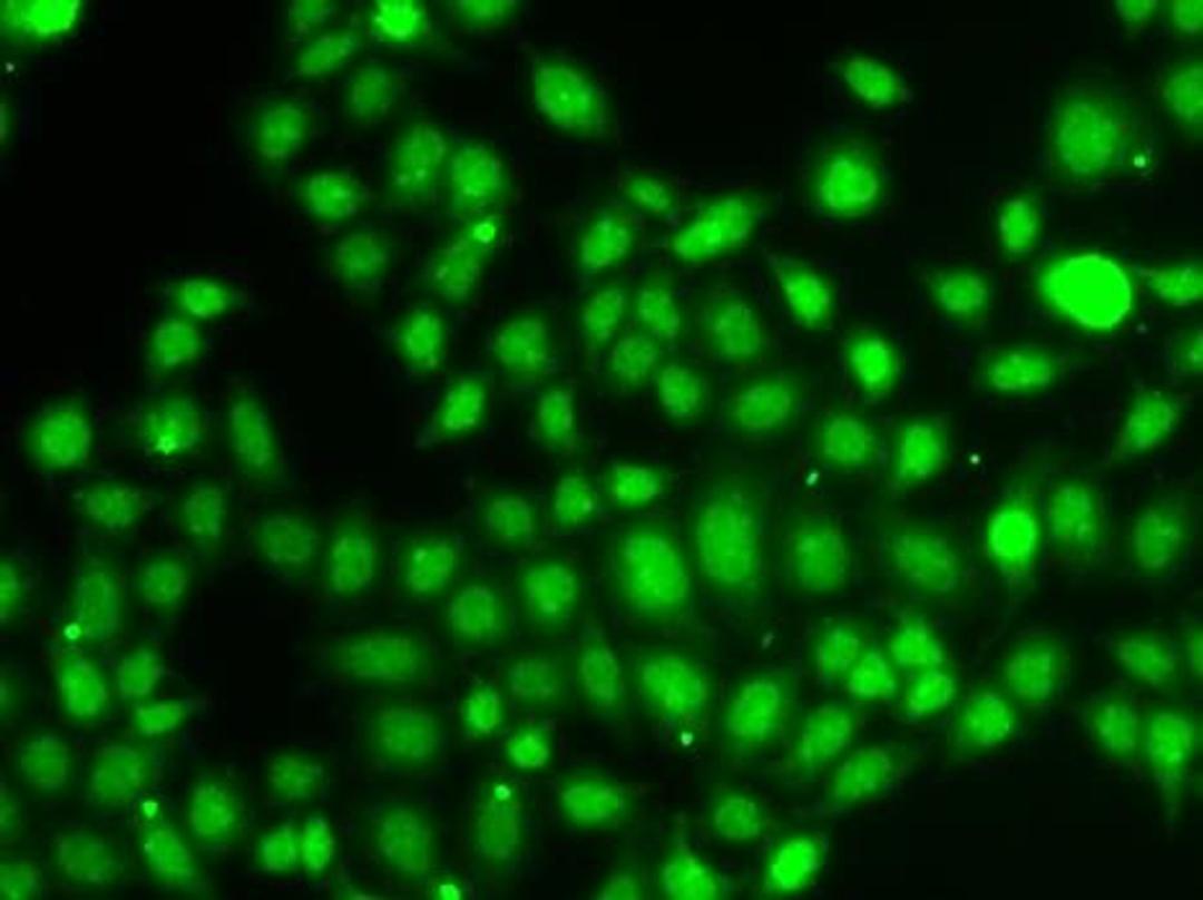 Immunofluorescence analysis of A549 cell using TXNL4B antibody