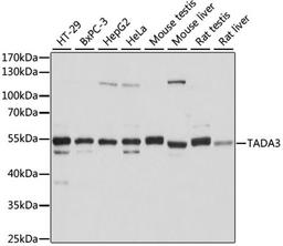 Western blot - TADA3 antibody (A6224)