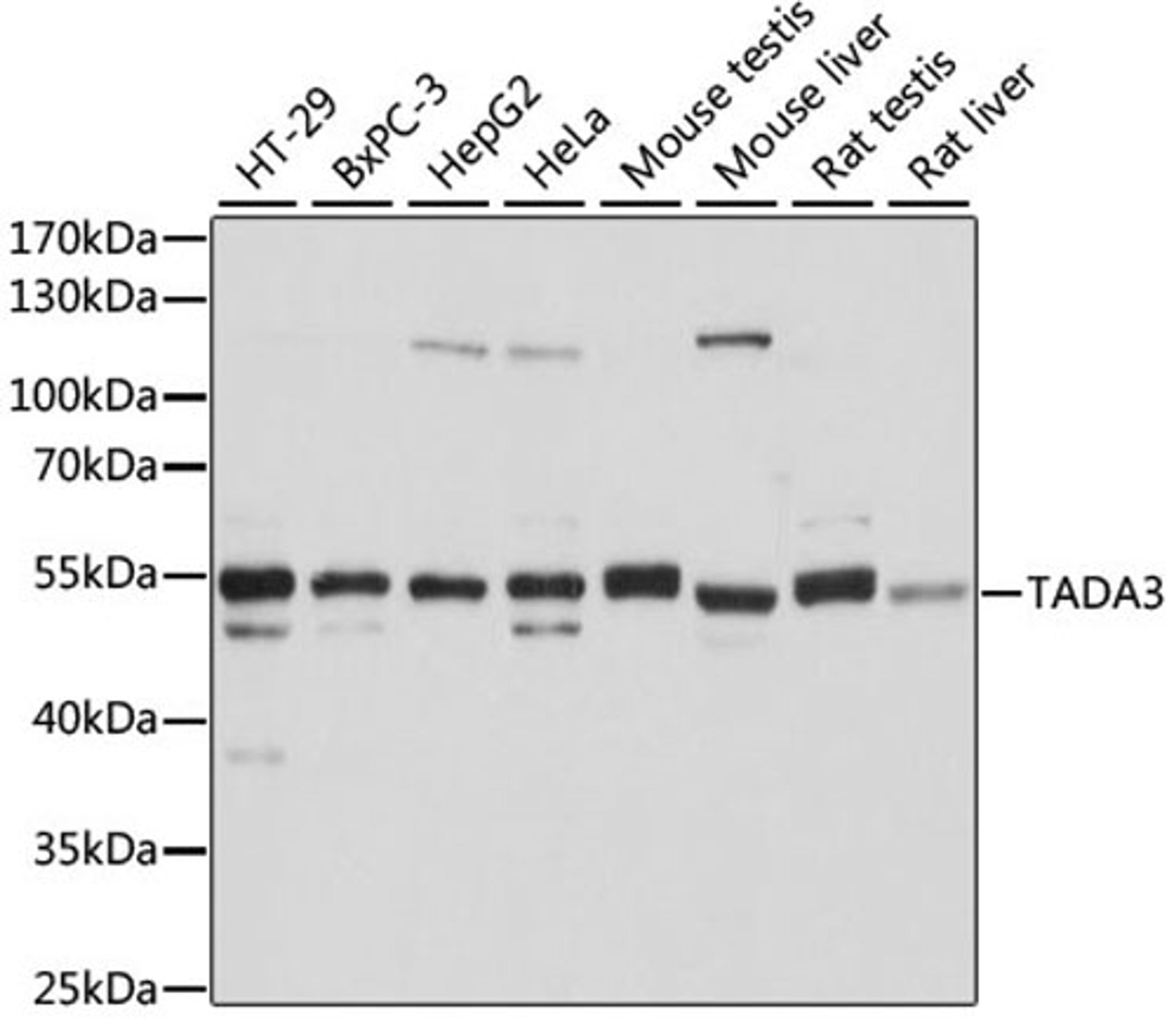 Western blot - TADA3 antibody (A6224)