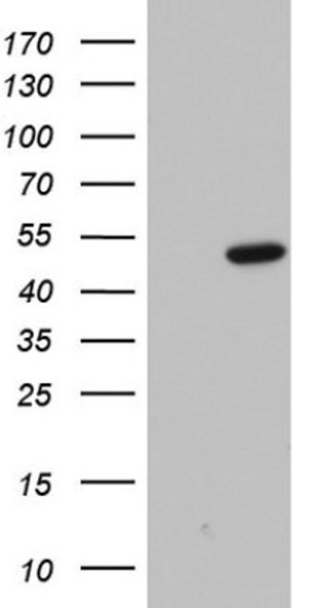 Western Blot: Macro H2A.2 Antibody (1C2) [NBP2-45930] - Analysis of HEK293T cells were transfected with the pCMV6-ENTRY control (Left lane) or pCMV6-ENTRY H2A.2.