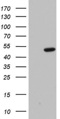 Western Blot: Macro H2A.2 Antibody (1C2) [NBP2-45930] - Analysis of HEK293T cells were transfected with the pCMV6-ENTRY control (Left lane) or pCMV6-ENTRY H2A.2.