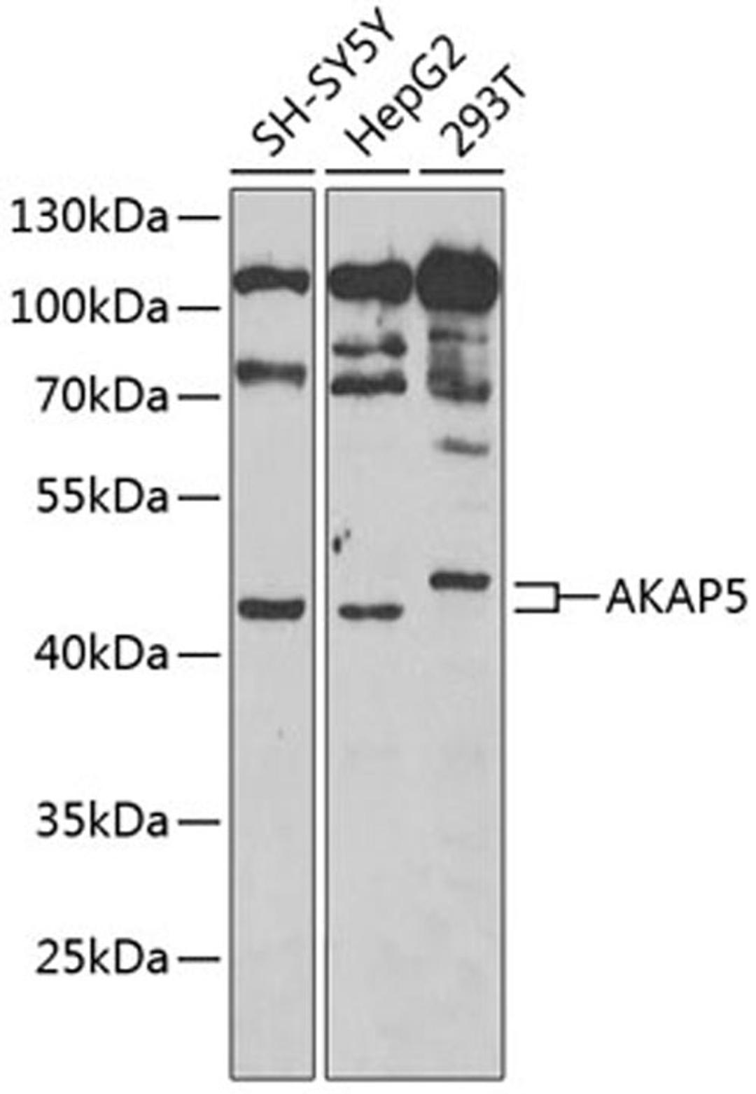 Western blot - AKAP5 Antibody (A6520)