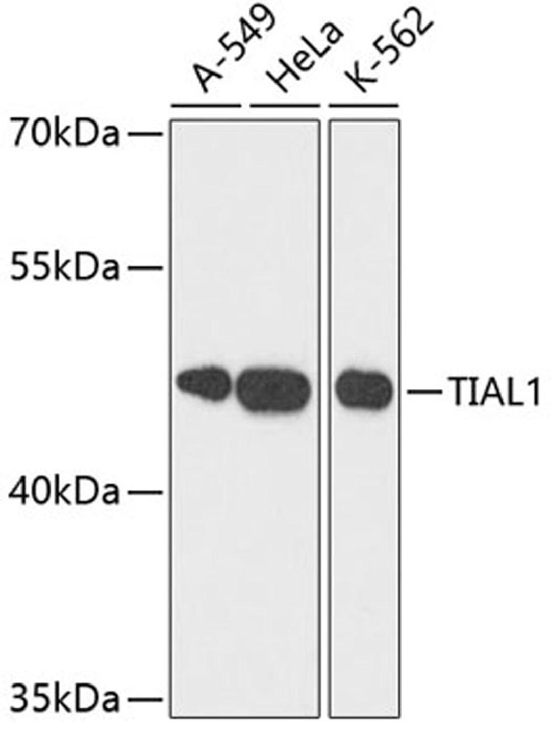 Western blot - TIAL1 antibody (A6075)