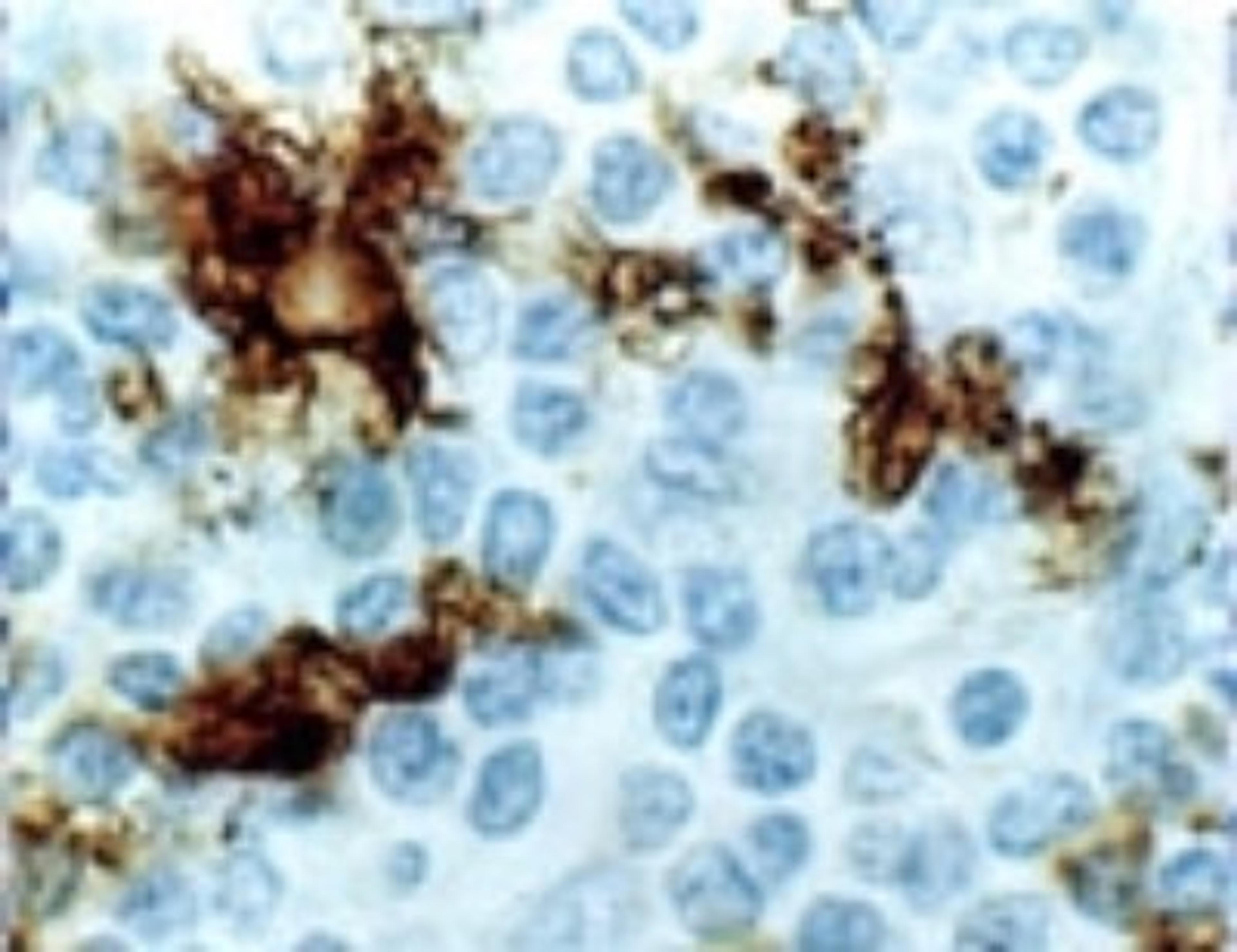 Immunohistochemistry-Paraffin: CD40 Antibody [NB100-56127] - Formalin-fixed paraffin-embedded tissue section of human tonsil stained for CD40 expression using this antibody at 1:2000. Staining is seen in the dendritic cells. Hematoxylin-eosin counterstain.