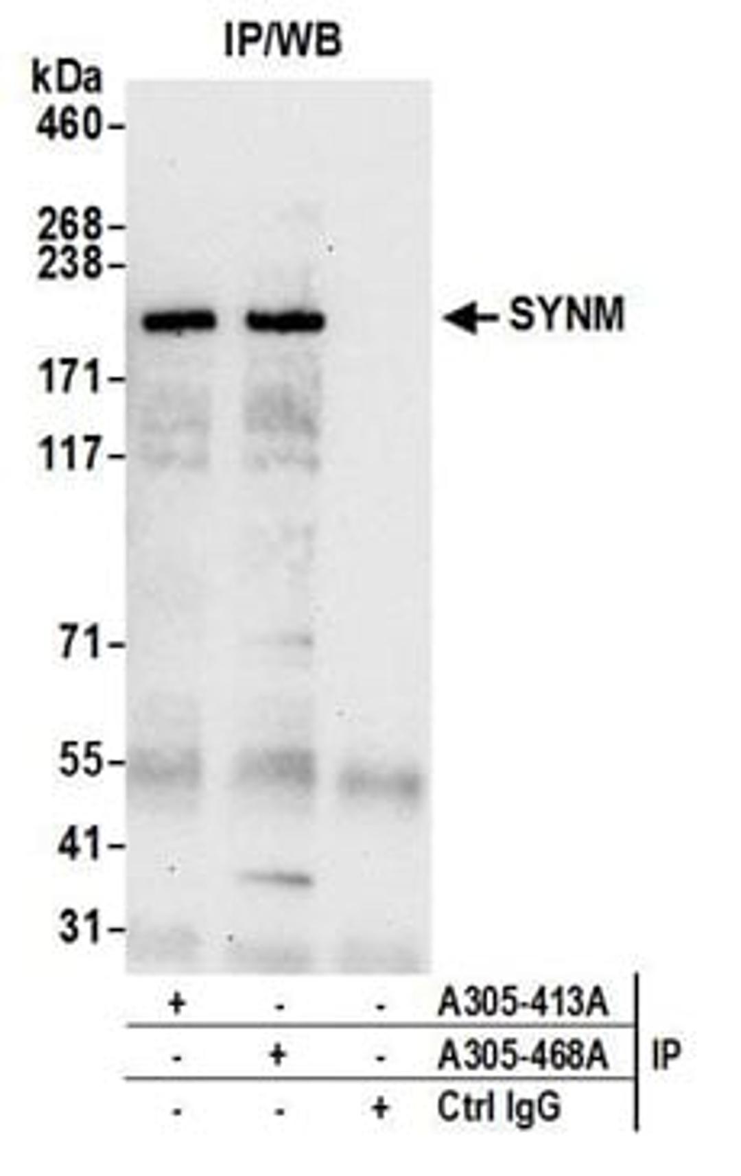 Detection of human SYNM by western blot of immunoprecipitates.