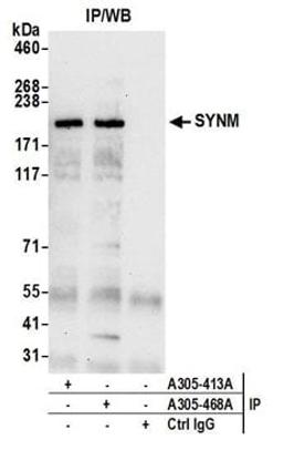 Detection of human SYNM by western blot of immunoprecipitates.