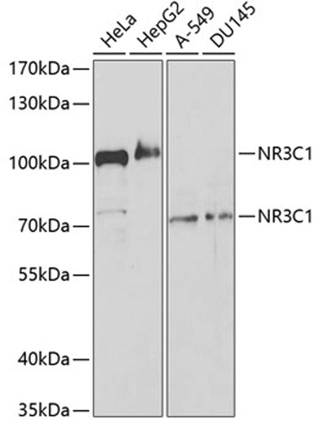 Western blot - NR3C1 antibody (A2164)