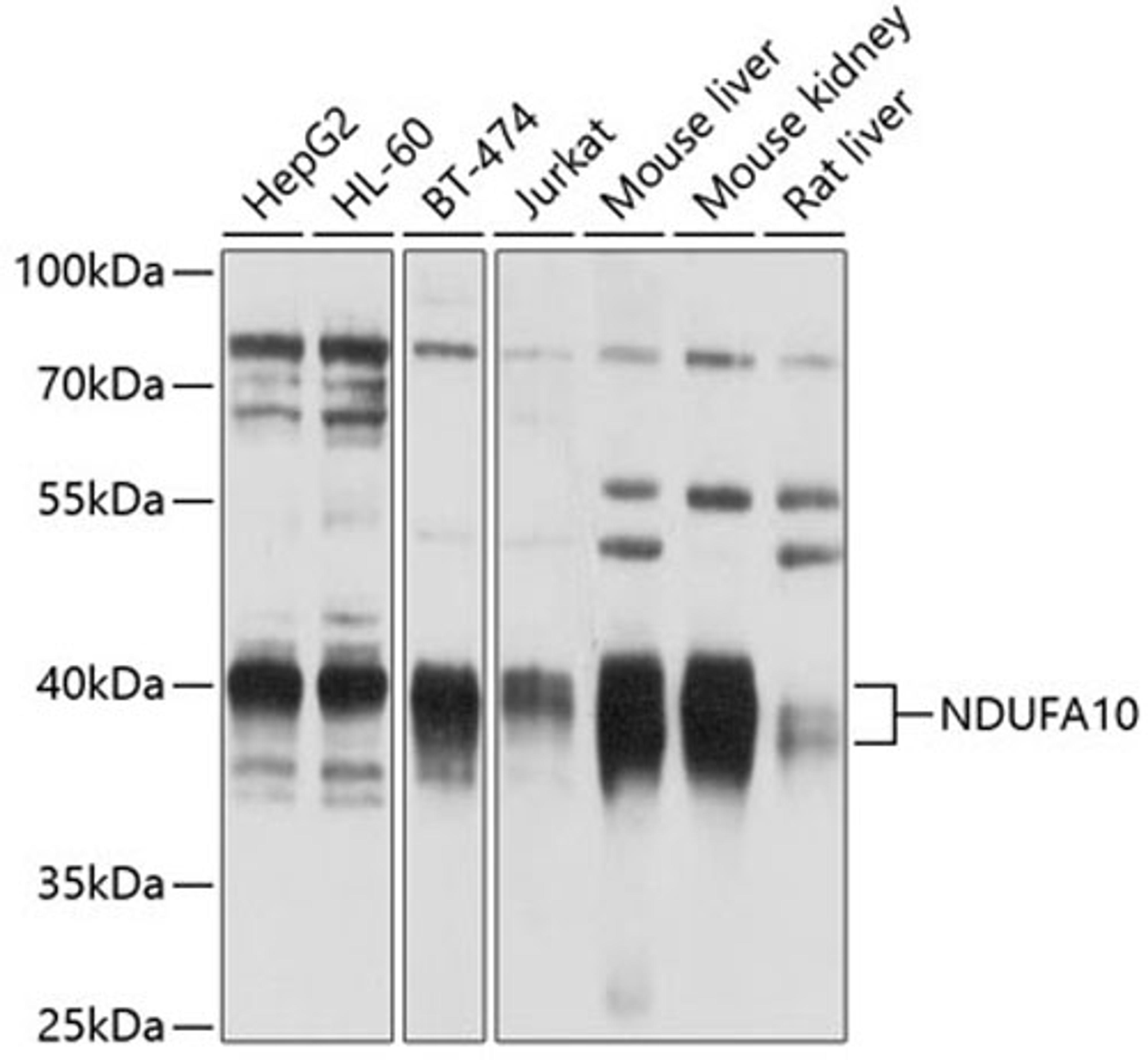 Western blot - NDUFA10 antibody (A10123)