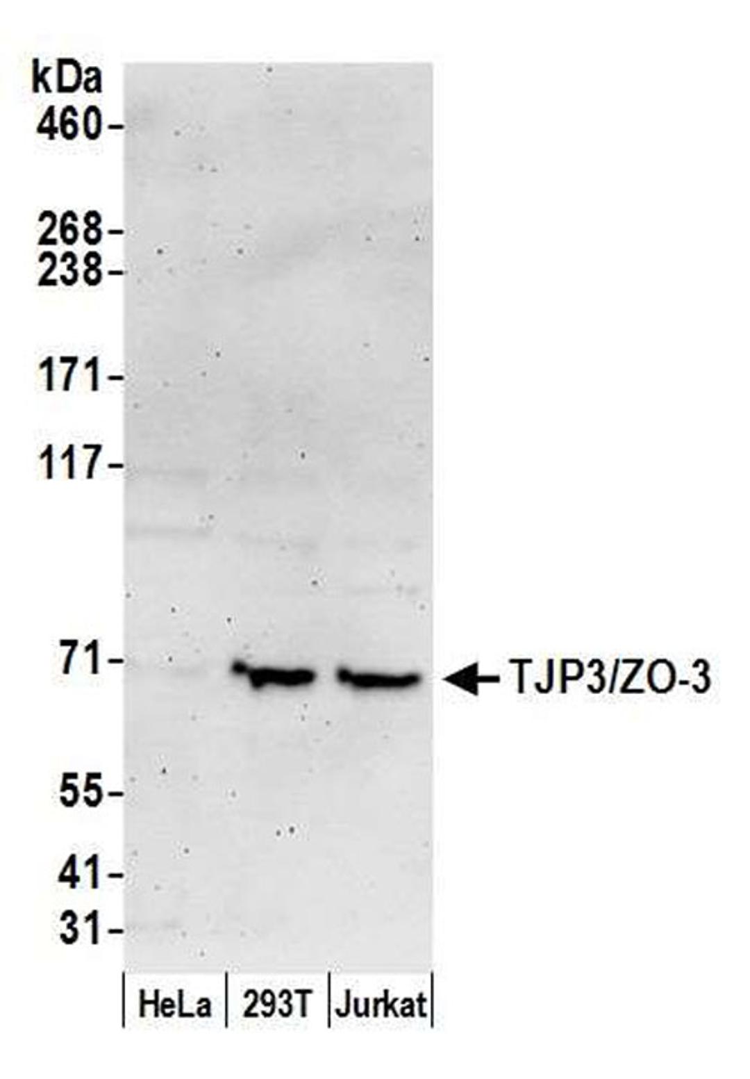 Detection of human TJP3/ZO-3 by WB.