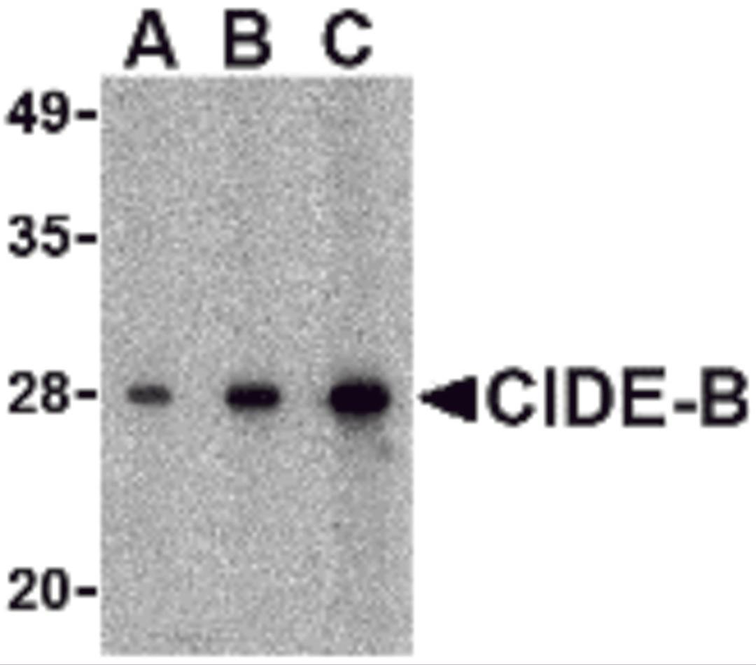 Western blot analysis of CIDE-B in mouse small intestine tissue lysate with CIDE-B antibody at (A) 0.5, (B) 1 and (C) 2 μg/mL.