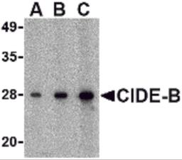 Western blot analysis of CIDE-B in mouse small intestine tissue lysate with CIDE-B antibody at (A) 0.5, (B) 1 and (C) 2 μg/mL.