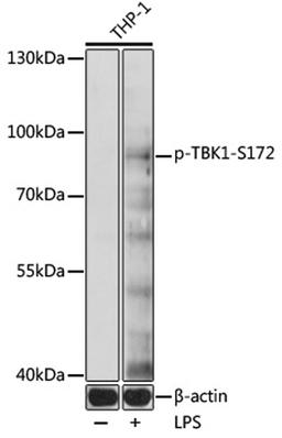 Western blot - Phospho-TBK1-S172 pAb (AP0847)