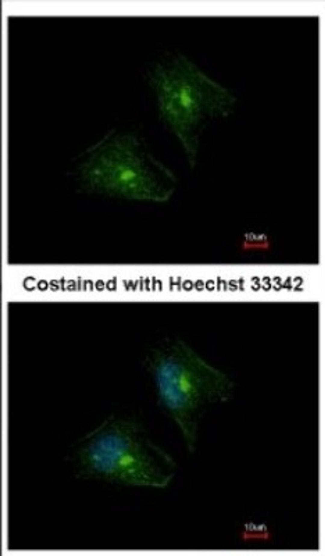 Immunocytochemistry/Immunofluorescence: PTPRH Antibody [NBP2-20005] - Immunofluorescence analysis of methanol-fixed HeLa, using antibody at 1:500 dilution.