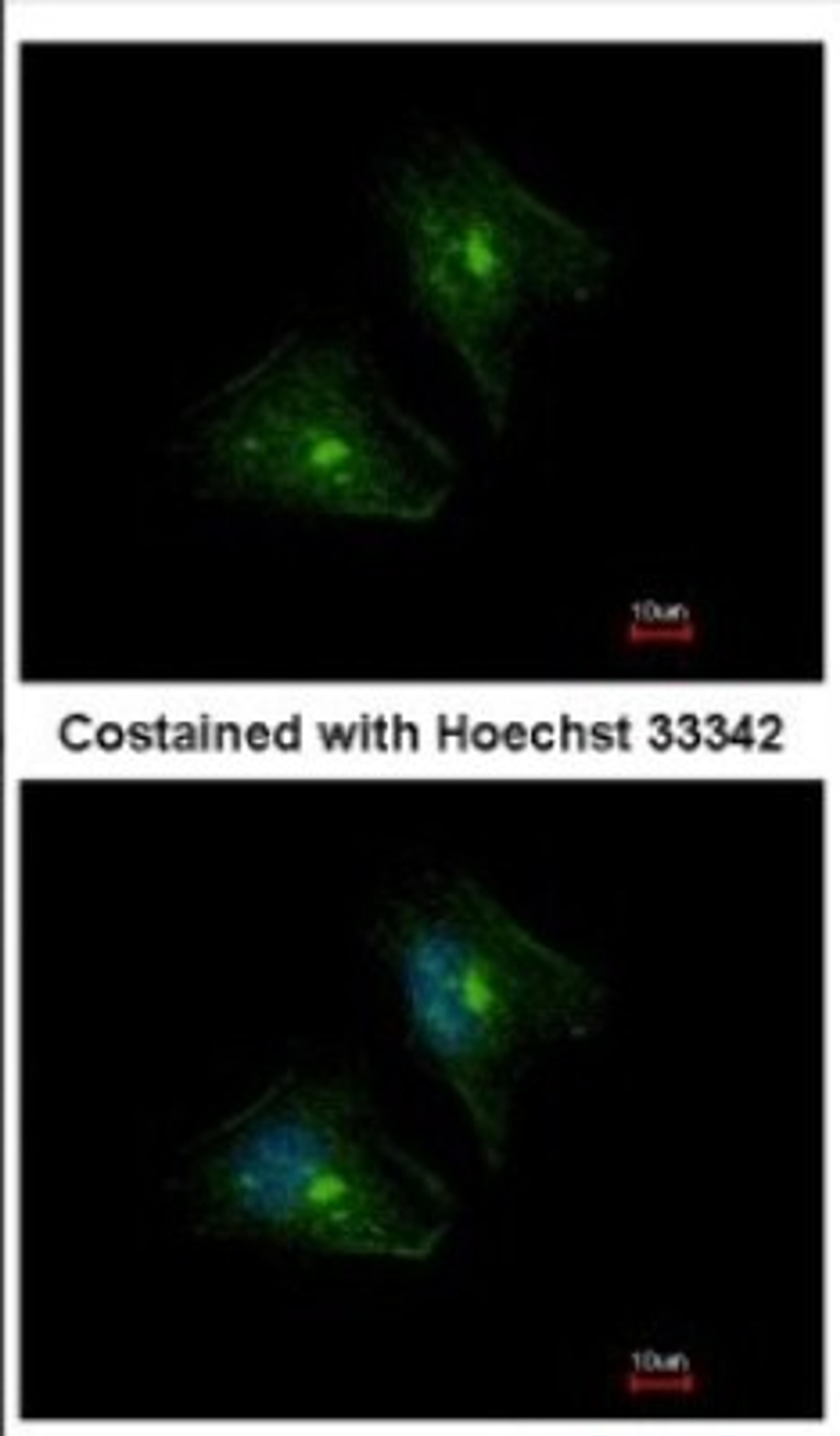 Immunocytochemistry/Immunofluorescence: PTPRH Antibody [NBP2-20005] - Immunofluorescence analysis of methanol-fixed HeLa, using antibody at 1:500 dilution.