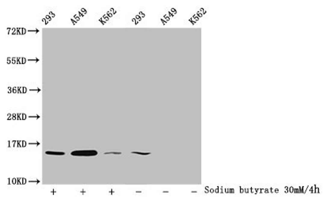 Western Blot. Detected samples: 293 whole cell lysate, A549 whole cell lysate, K562 whole cell lysate; Untreated (-) or treated (+) with 30mM sodium butyrate for 4h. All lanes: HIST1H2BC antibody at 1:100. Secondary. Goat polyclonal to rabbit IgG at 1/50000 dilution. Predicted band size: 14 kDa. Observed band size: 14 kDa