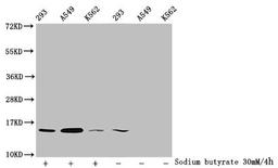 Western Blot. Detected samples: 293 whole cell lysate, A549 whole cell lysate, K562 whole cell lysate; Untreated (-) or treated (+) with 30mM sodium butyrate for 4h. All lanes: HIST1H2BC antibody at 1:100. Secondary. Goat polyclonal to rabbit IgG at 1/50000 dilution. Predicted band size: 14 kDa. Observed band size: 14 kDa