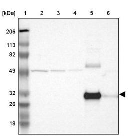 Western Blot: Mannose Binding Lectin Antibody [NBP1-85518] - Lane 1: Marker [kDa] 206, 113, 82, 49, 32, 26, 18<br/>Lane 2: Human cell line RT-4<br/>Lane 3: Human cell line U-251MG sp<br/>Lane 4: Human cell line A-431<br/>Lane 5: Human liver tissue<br/>Lane 6: Human tonsil tissue