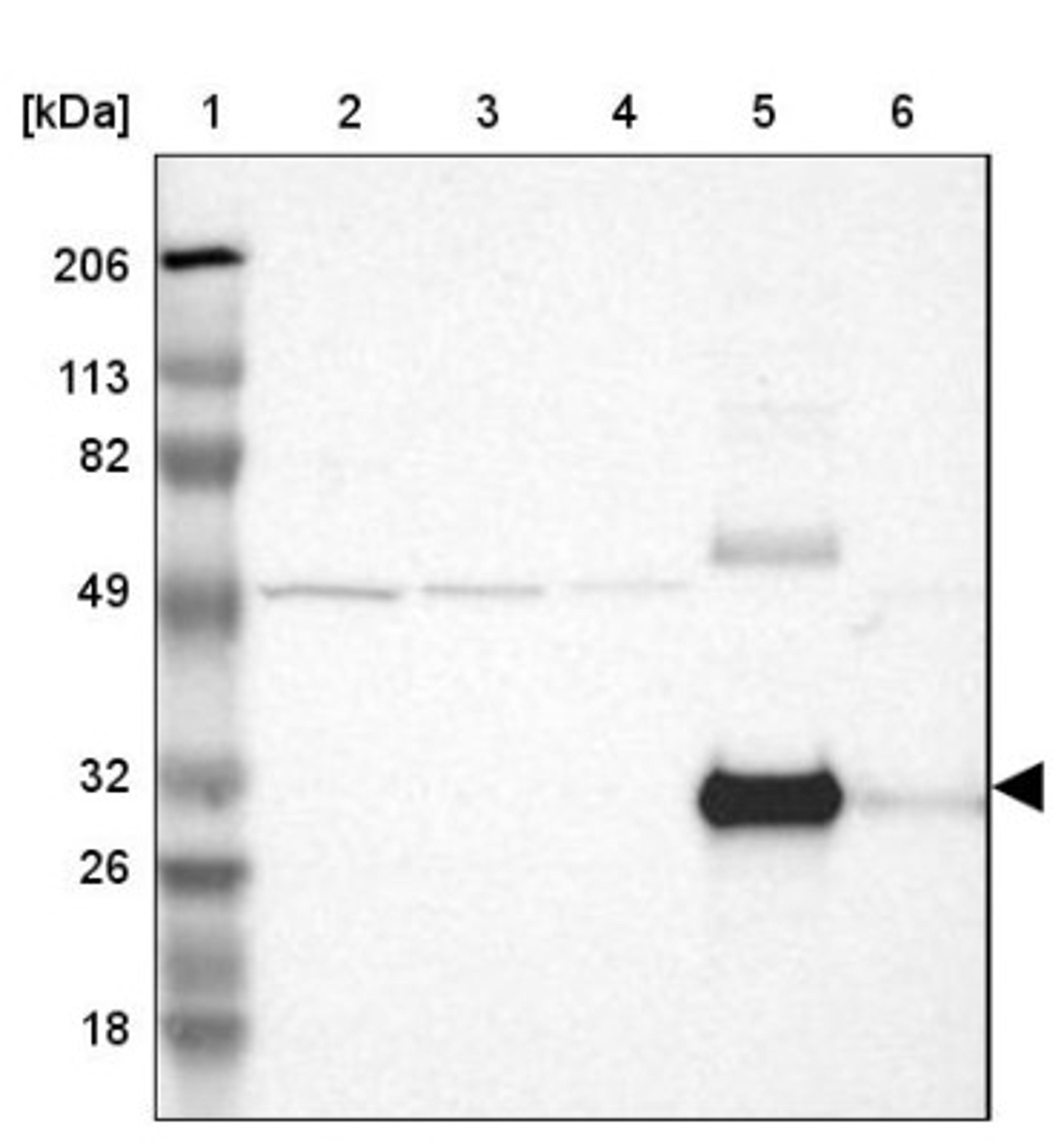 Western Blot: Mannose Binding Lectin Antibody [NBP1-85518] - Lane 1: Marker [kDa] 206, 113, 82, 49, 32, 26, 18<br/>Lane 2: Human cell line RT-4<br/>Lane 3: Human cell line U-251MG sp<br/>Lane 4: Human cell line A-431<br/>Lane 5: Human liver tissue<br/>Lane 6: Human tonsil tissue