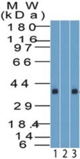 Western Blot: KLF8 Antibody [NBP2-27418] - Analysis of KLF8 using KLF8 antibody. Human Kidney tissue lysate in the 1) absence and 2) presence of immunizing peptide and 3) HEK293 lysate probed with 2 ug/ml of KLF8 antibody. Goat anti-rabbit Ig HRP secondary antibody and PicoTect ECL substrate solution were used for this test.