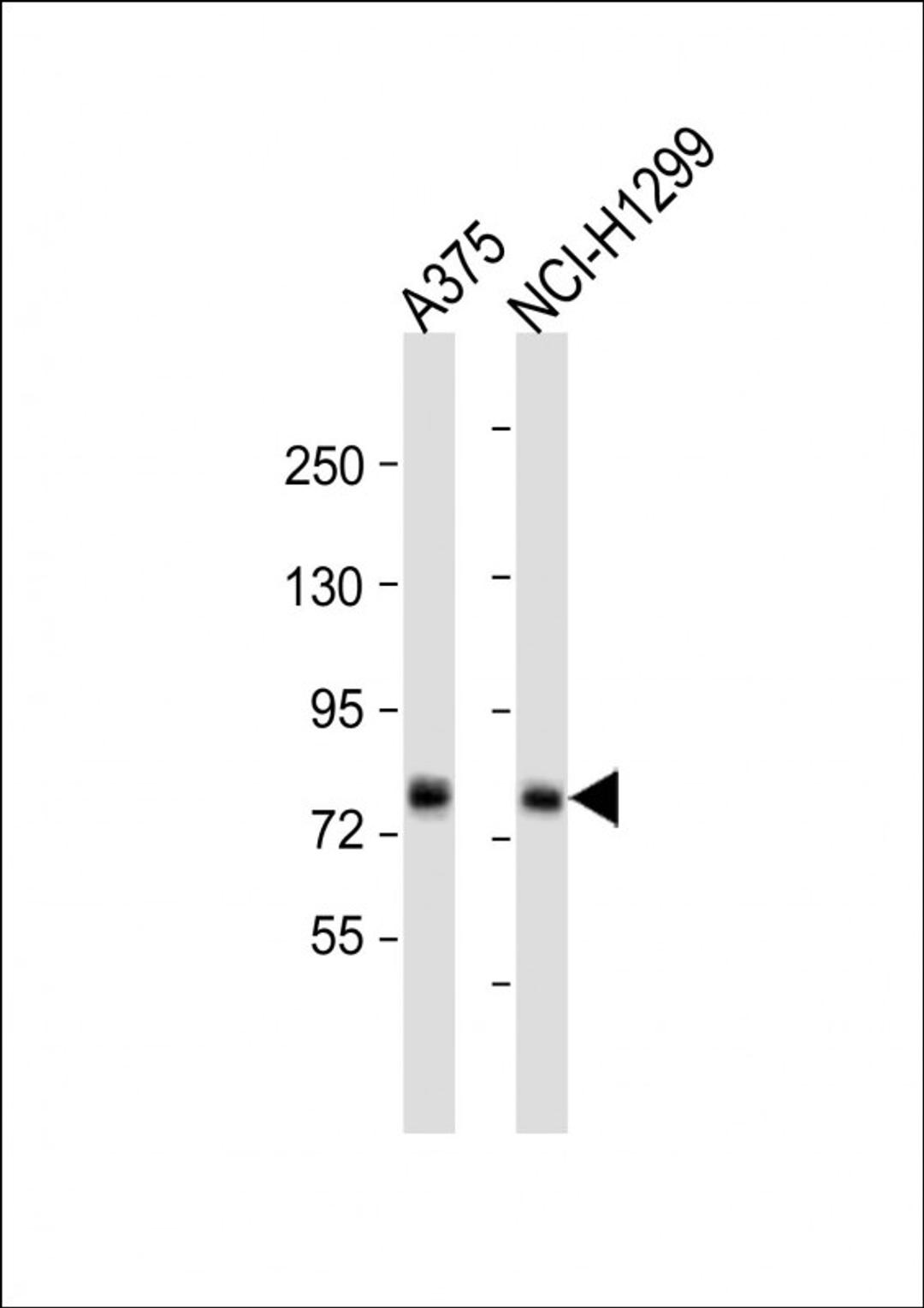 Western Blot at 1:1000 dilution Lane 1: A375 whole cell lysate Lane 2: NCI-H1299 whole cell lysate Lysates/proteins at 20 ug per lane.