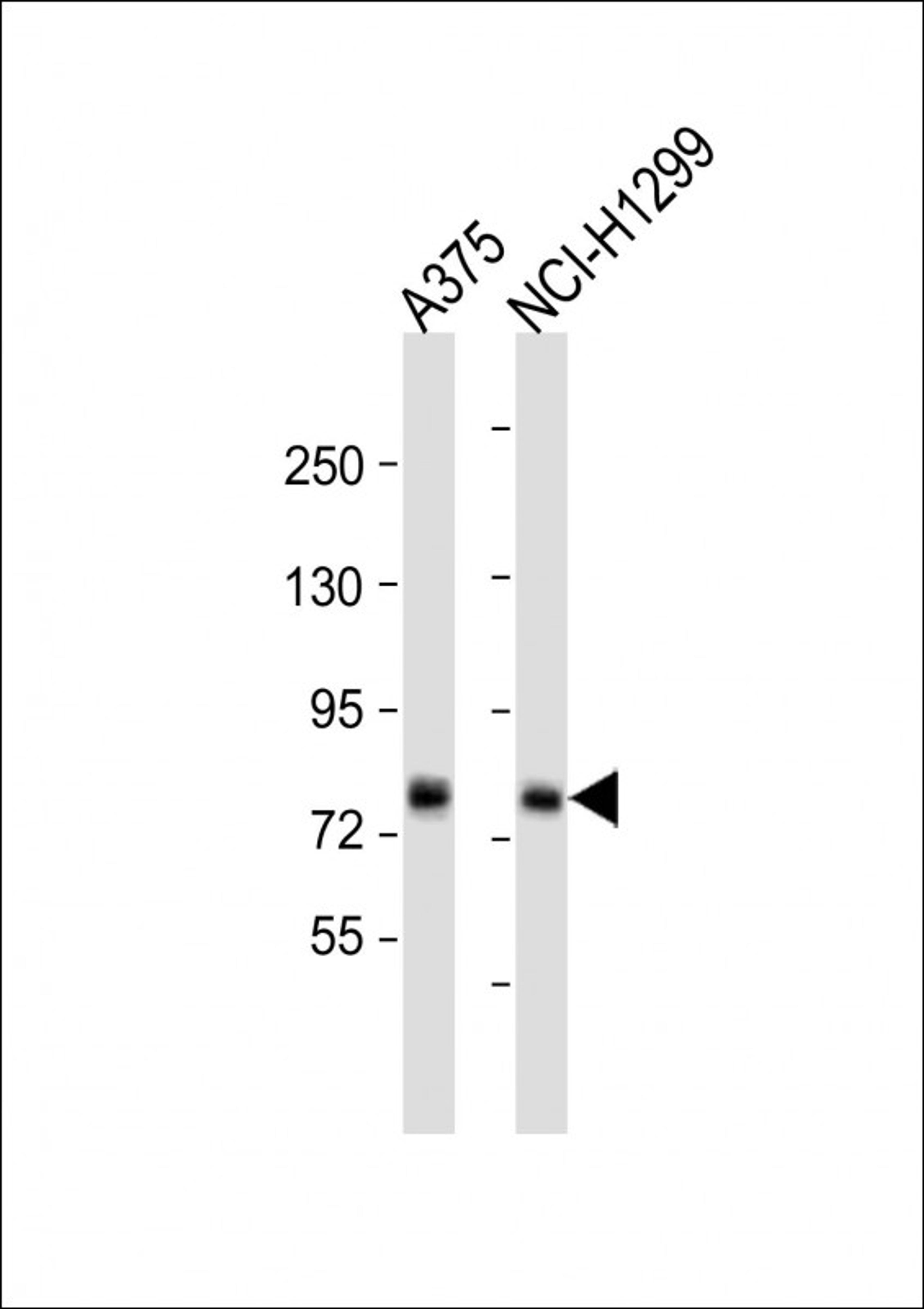 Western Blot at 1:1000 dilution Lane 1: A375 whole cell lysate Lane 2: NCI-H1299 whole cell lysate Lysates/proteins at 20 ug per lane.