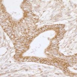 Detection of human TRAP1/HSP75 by immunohistochemistry.