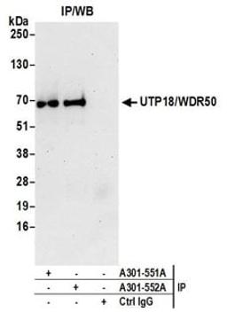 Detection of human UTP18/WDR50 by western blot of immunoprecipitates.