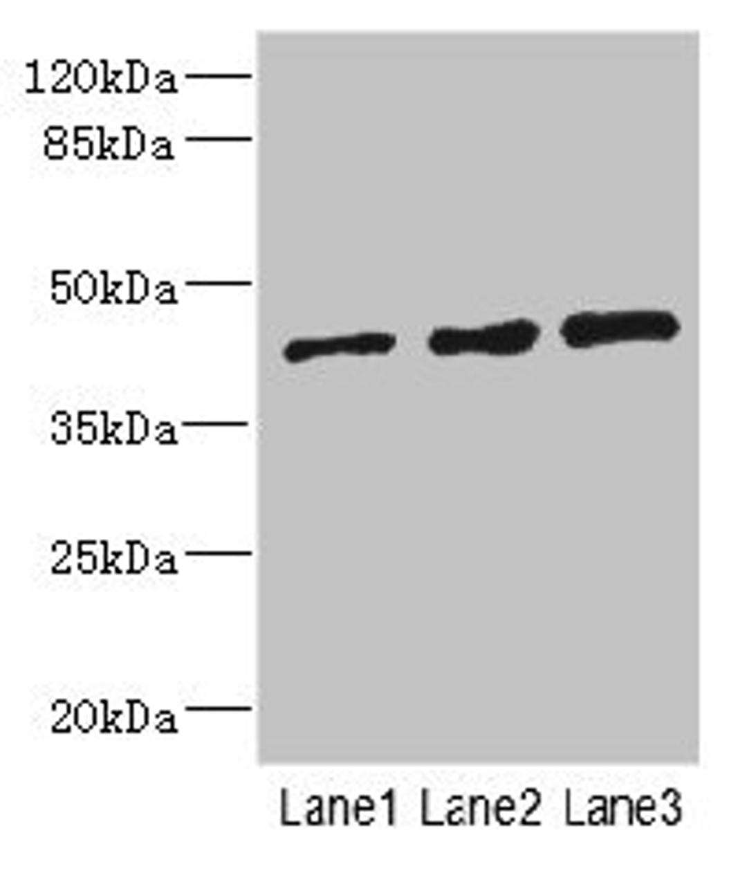 Western blot. All lanes: ZNF24 antibody at 2.88µg/ml. Lane 1: 293T whole cell lysate. Lane 2: Jurkat whole cell lysate. Lane 3: Hela whole cell lysate. Secondary. Goat polyclonal to rabbit IgG at 1/10000 dilution. Predicted band size: 43, 23 kDa. Observed band size: 43 kDa