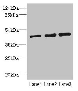 Western blot. All lanes: ZNF24 antibody at 2.88µg/ml. Lane 1: 293T whole cell lysate. Lane 2: Jurkat whole cell lysate. Lane 3: Hela whole cell lysate. Secondary. Goat polyclonal to rabbit IgG at 1/10000 dilution. Predicted band size: 43, 23 kDa. Observed band size: 43 kDa