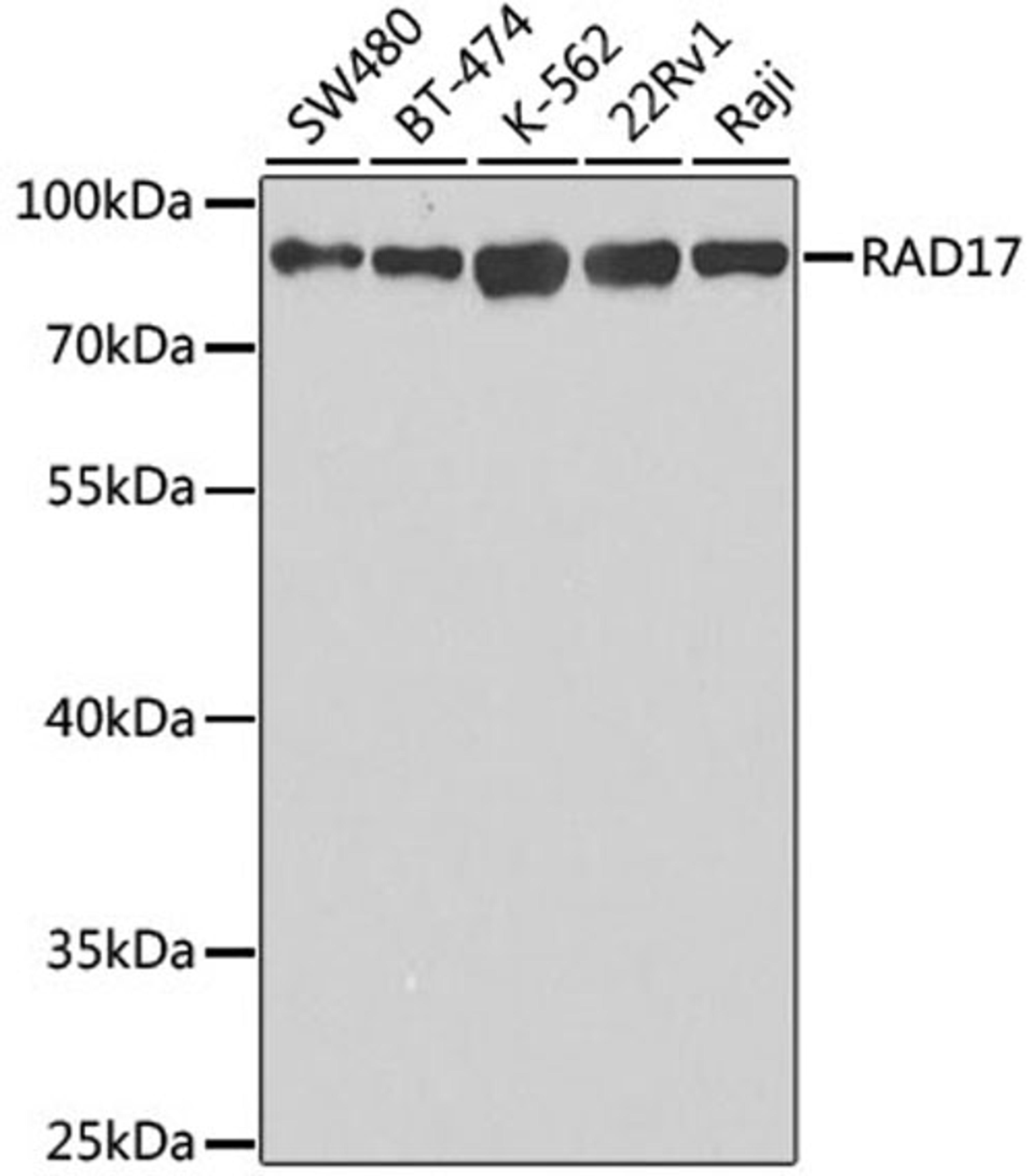 Western blot - RAD17 antibody (A5359)