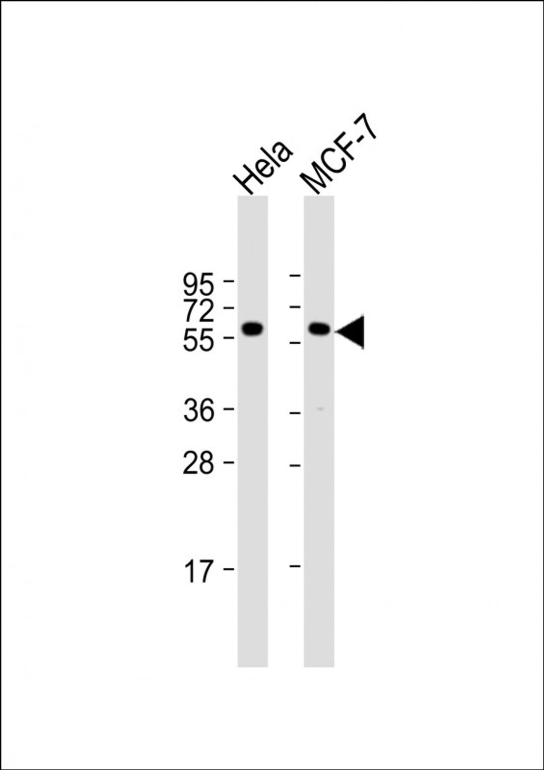 Western Blot at 1:1000 dilution Lane 1: Hela whole cell lysate Lane 2: MCF-7 whole cell lysate Lysates/proteins at 20 ug per lane.