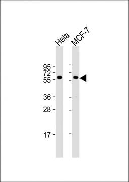 Western Blot at 1:1000 dilution Lane 1: Hela whole cell lysate Lane 2: MCF-7 whole cell lysate Lysates/proteins at 20 ug per lane.