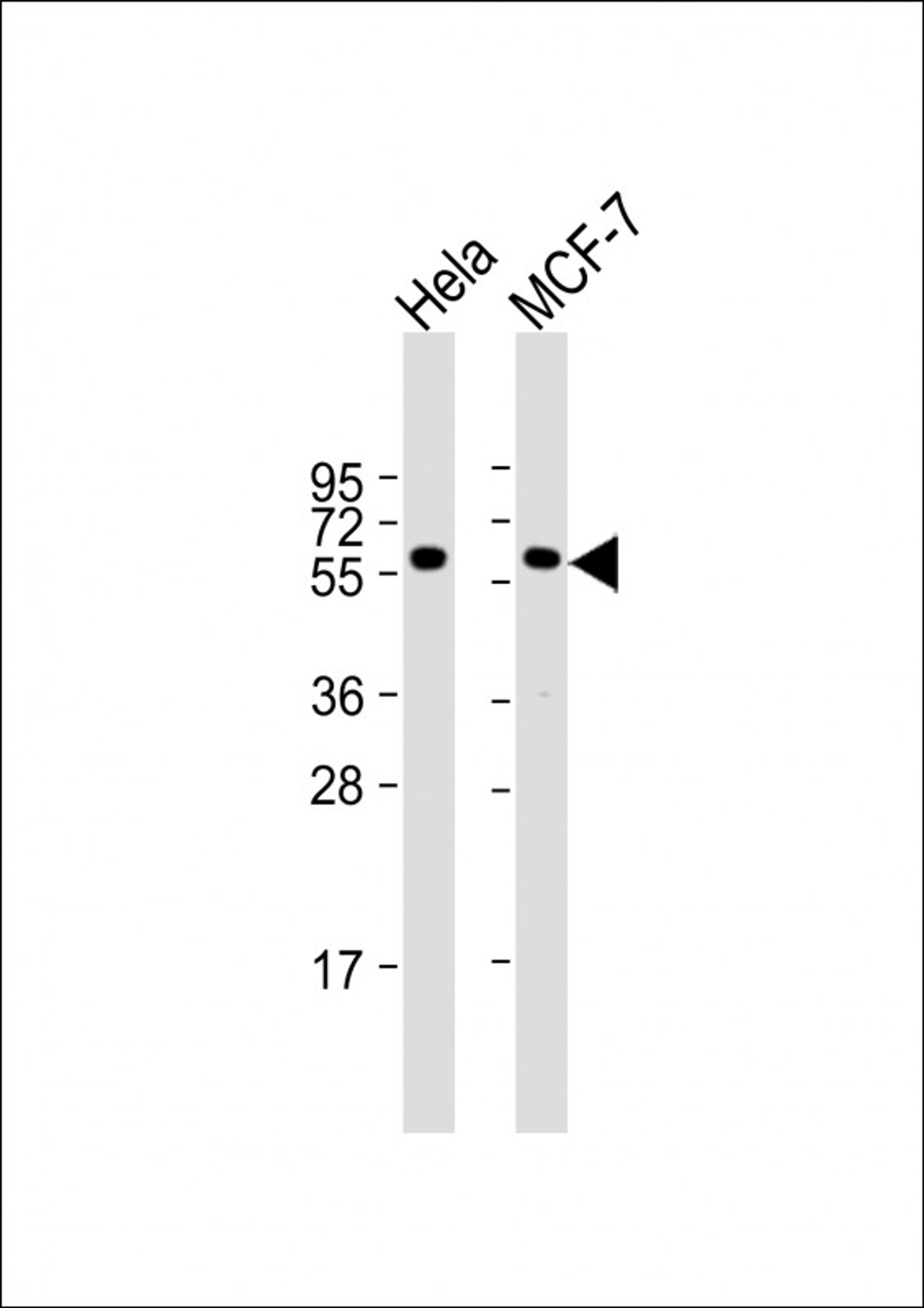 Western Blot at 1:1000 dilution Lane 1: Hela whole cell lysate Lane 2: MCF-7 whole cell lysate Lysates/proteins at 20 ug per lane.