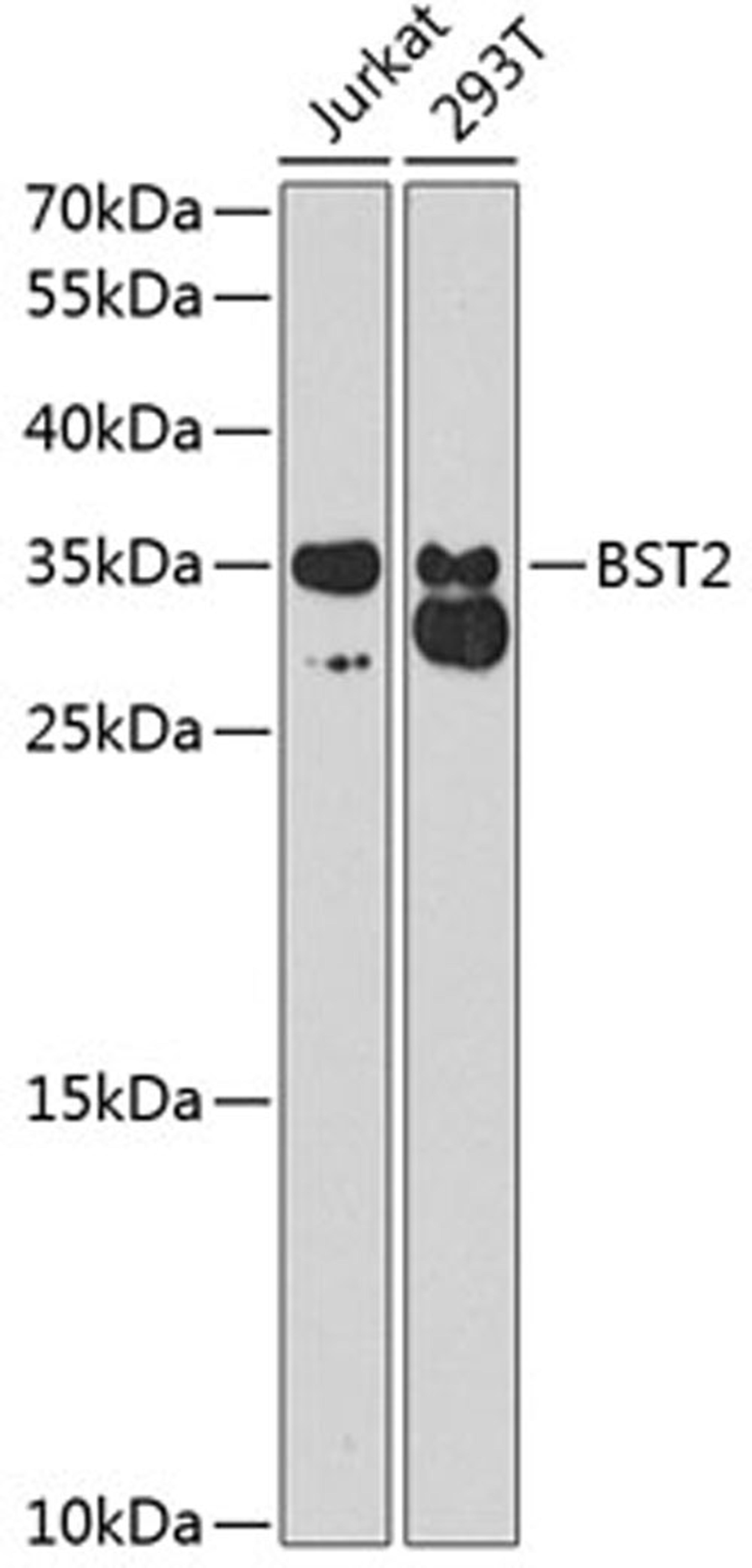 Western blot - BST2 antibody (A1914)