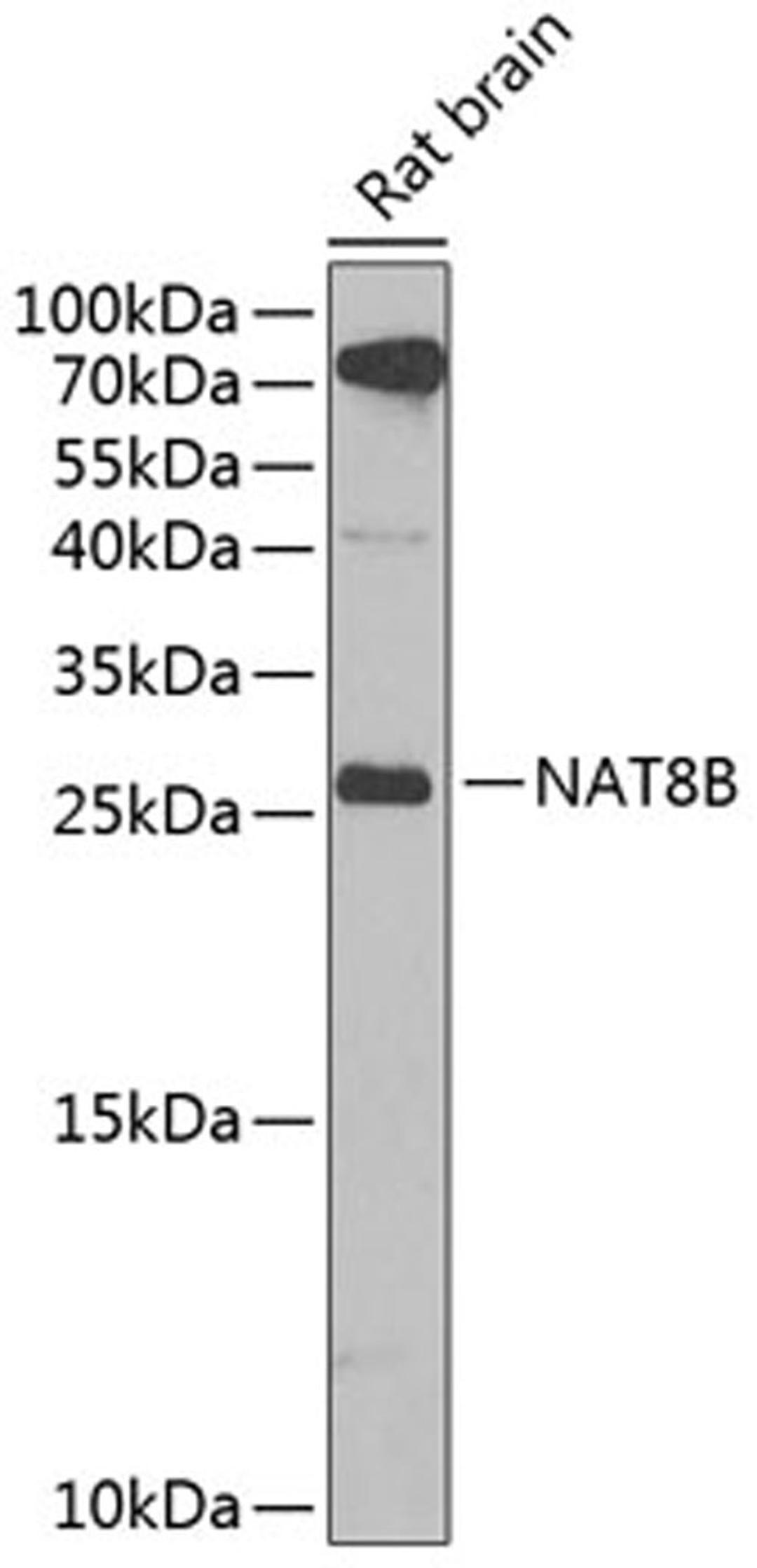 Western blot - NAT8B antibody (A7203)