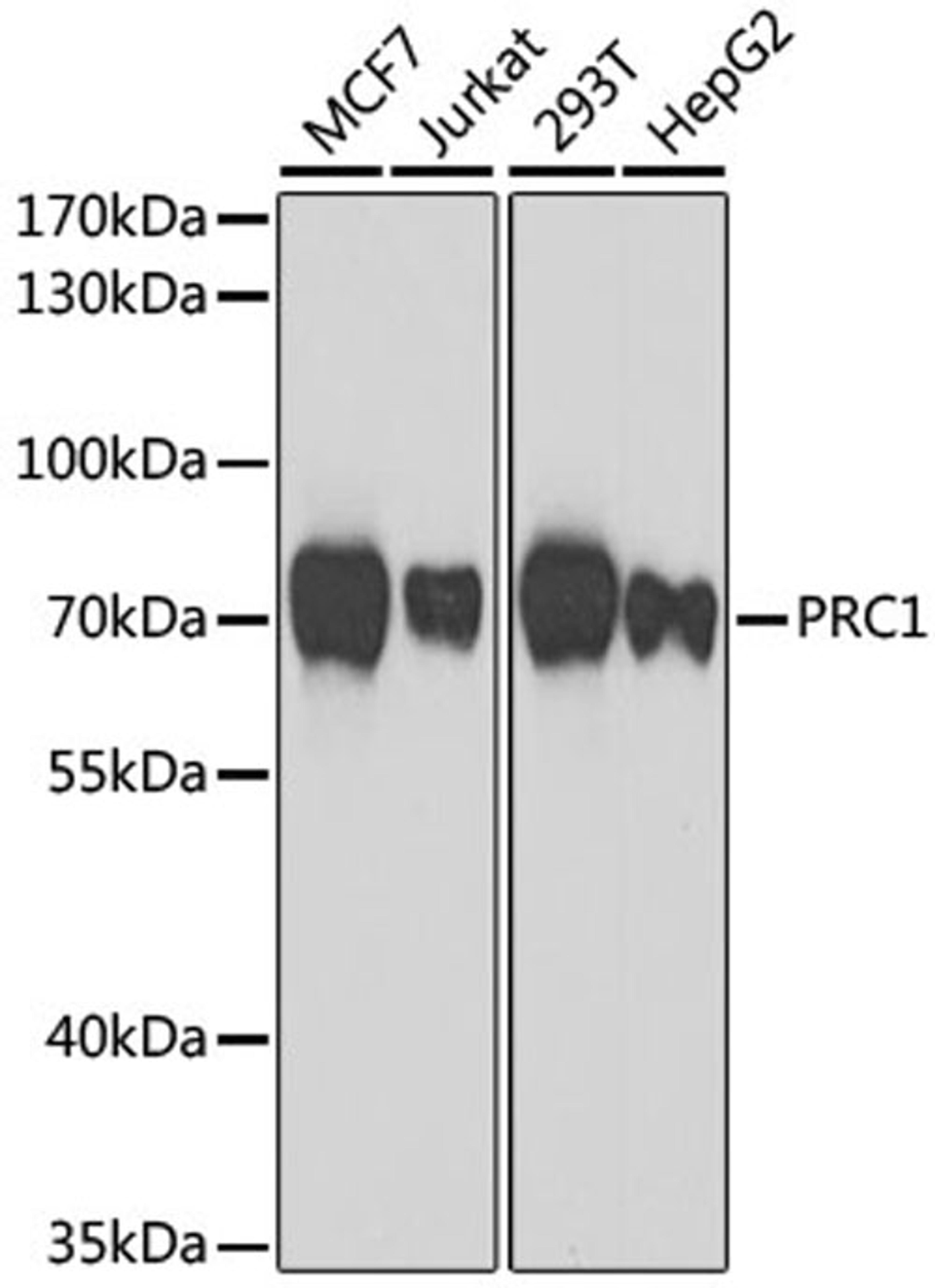 Western blot - PRC1 antibody (A7029)