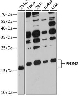 Western blot - PFDN2 antibody (A12269)