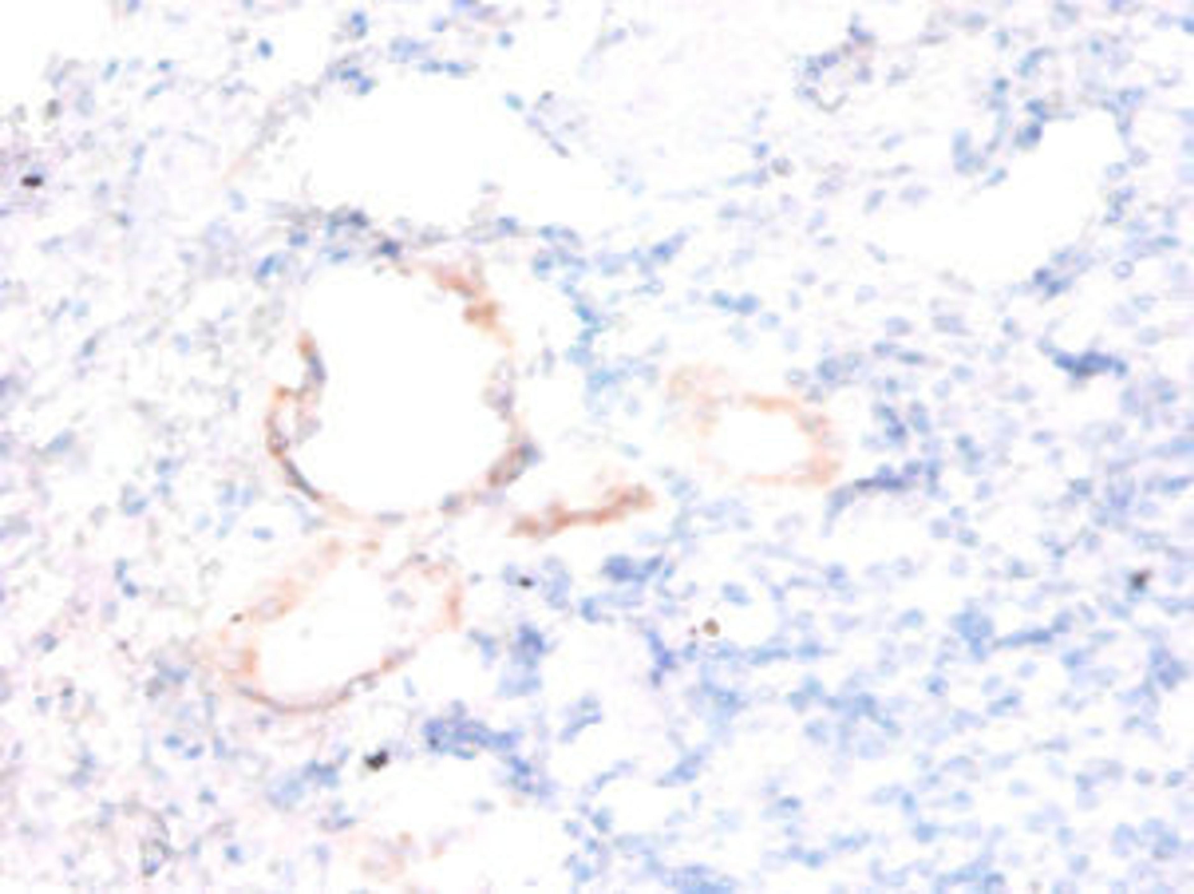 Immunohistochemistry of paraffin-embedded human kidney tissue using CSB-PA01704A0Rb at dilution of 1:50
