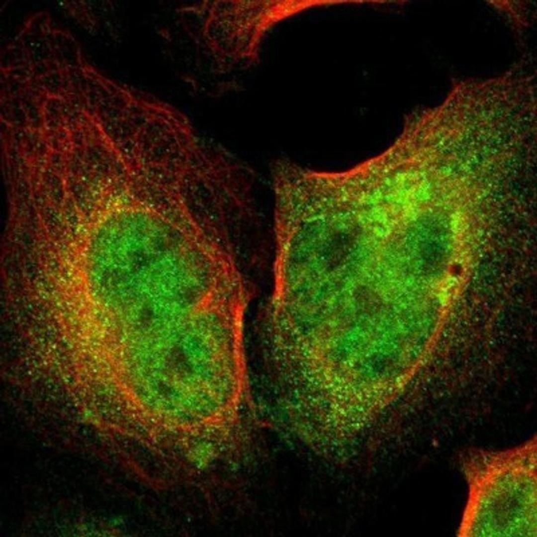 Immunocytochemistry/Immunofluorescence: Cytokeratin 7 Antibody [NBP1-88080] - Staining of human cell line U-2 OS shows positivity in nucleus but not nucleoli, cytoplasm & golgi apparatus.