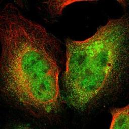 Immunocytochemistry/Immunofluorescence: Cytokeratin 7 Antibody [NBP1-88080] - Staining of human cell line U-2 OS shows positivity in nucleus but not nucleoli, cytoplasm & golgi apparatus.