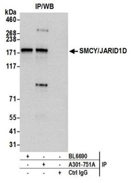 Detection of human SMCY/JARID1D by western blot of immunoprecipitates.