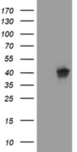 Western Blot: Wnt3 Antibody (1G7) [NBP2-46367] - Analysis of HEK293T cells were transfected with the pCMV6-ENTRY control (Left lane) or pCMV6-ENTRY WNT3.