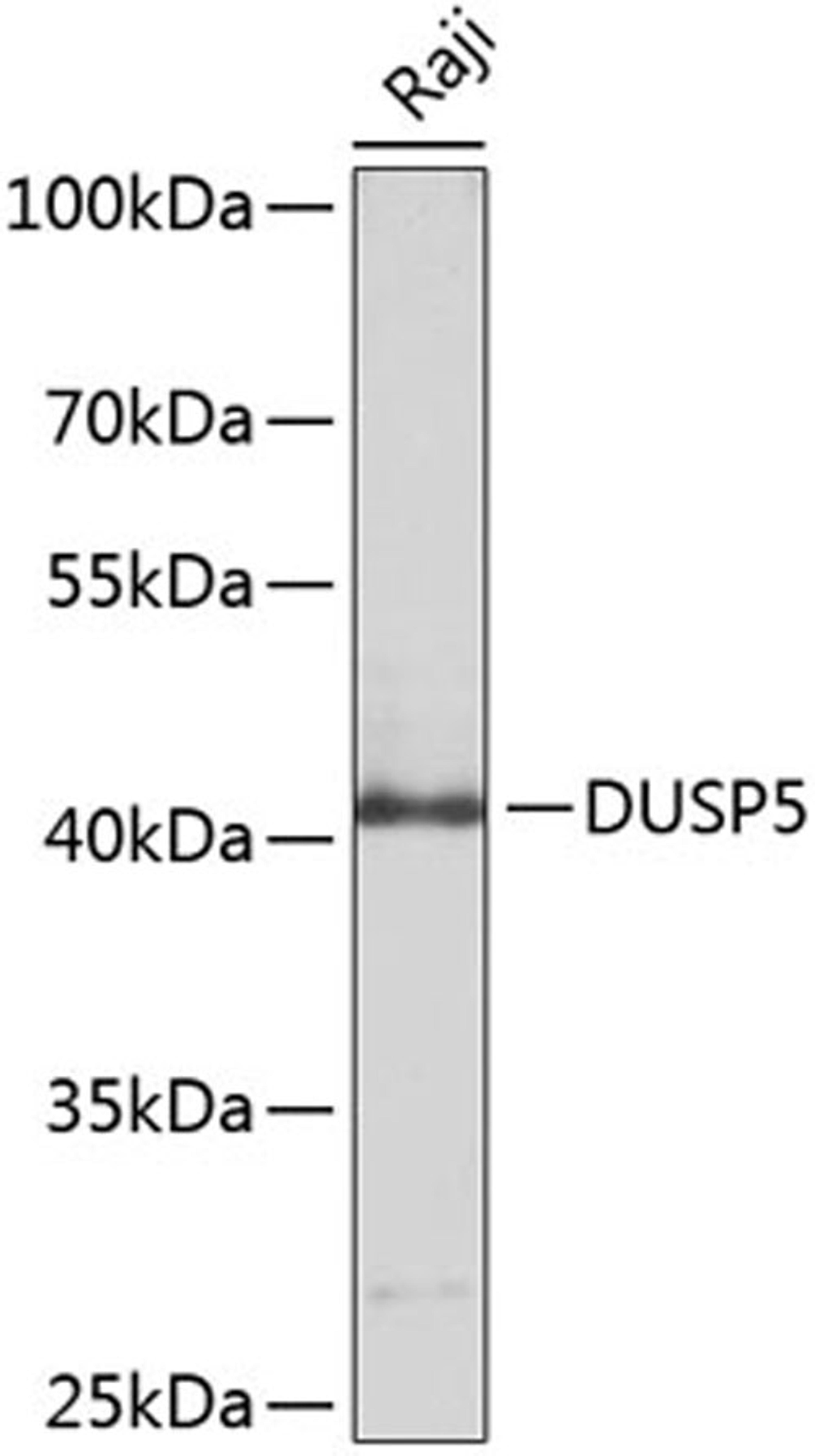 Western blot - DUSP5 antibody (A10212)