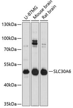 Western blot - SLC30A6 Antibody (A11644)